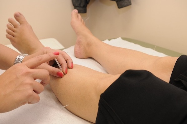 acupuncture for osteoarthritis