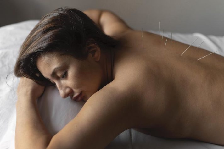 acupuncture for vomiting