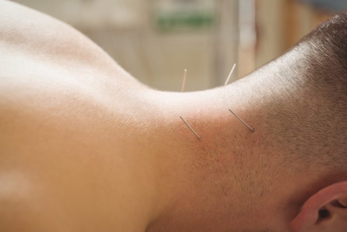 acupuncture for neck pain